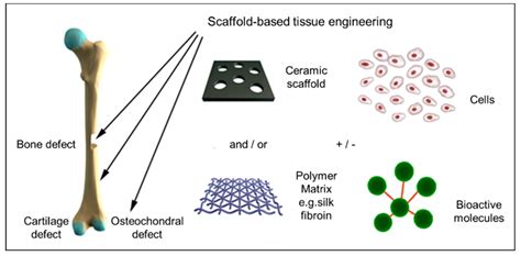  Gelatin: A Revolutionary Biomaterial for Bone Tissue Engineering and Controlled Drug Delivery?